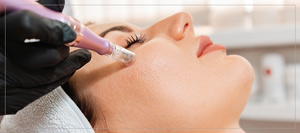 Microneedling Specialist Near Me in Omaha, NE