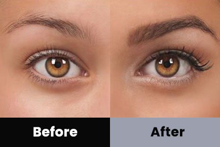 Before and After Image: Esthetic Services - front