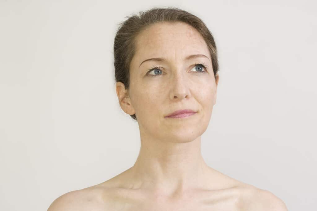 Woman with smooth skin after anti-aging treatment that supports collagen production.